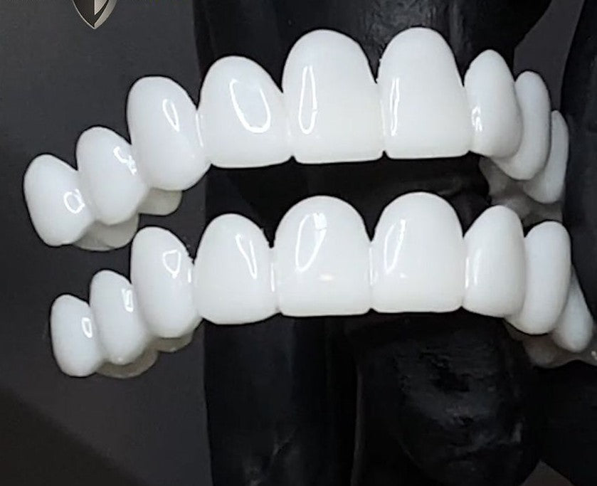 Easy-fit removable tooth veneer providing a natural, aesthetic instant smile.